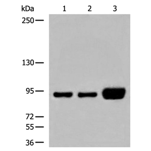 DDX27 rabbit polyclonal antibody