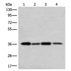 NIFK rabbit polyclonal antibody