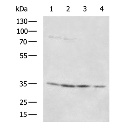 MRPL1 rabbit polyclonal antibody