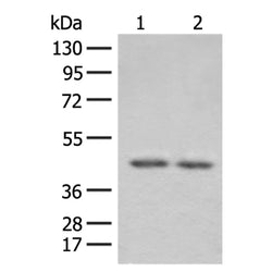 ILKAP rabbit polyclonal antibody