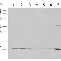 RPS27L rabbit polyclonal antibody