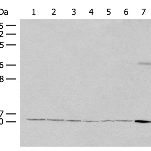 RPS27L rabbit polyclonal antibody