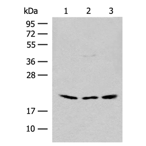 RPL23A rabbit polyclonal antibody