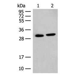 GLYAT rabbit polyclonal antibody