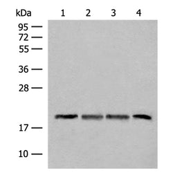 SEC11A rabbit polyclonal antibody