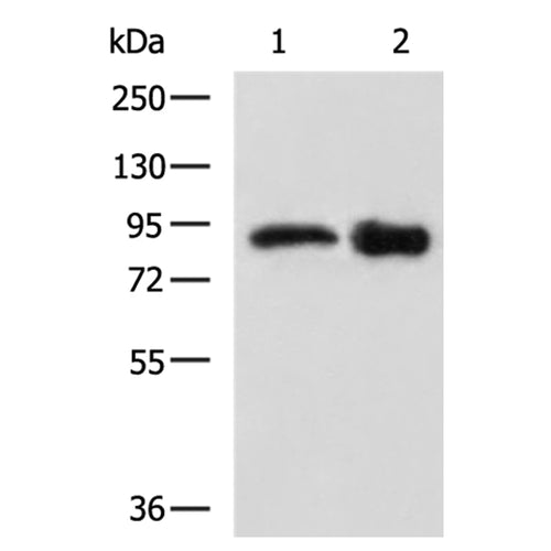 APP rabbit polyclonal antibody
