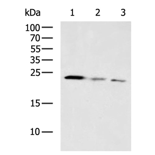 CRH rabbit polyclonal antibody