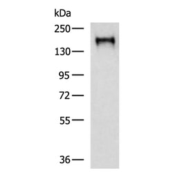 EGFR rabbit polyclonal antibody