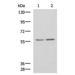 ESR2 rabbit polyclonal antibody