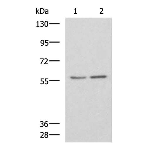 ESR2 rabbit polyclonal antibody