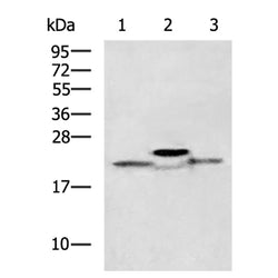 CLDN1 rabbit polyclonal antibody