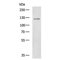 TERT rabbit polyclonal antibody