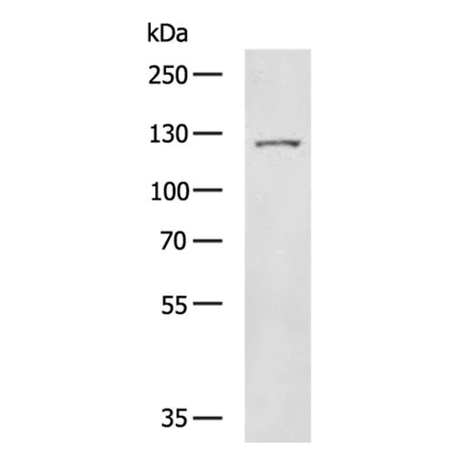 TERT rabbit polyclonal antibody