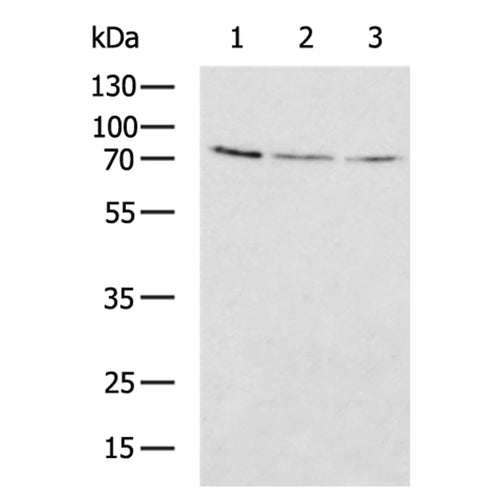 MASP2 rabbit polyclonal antibody
