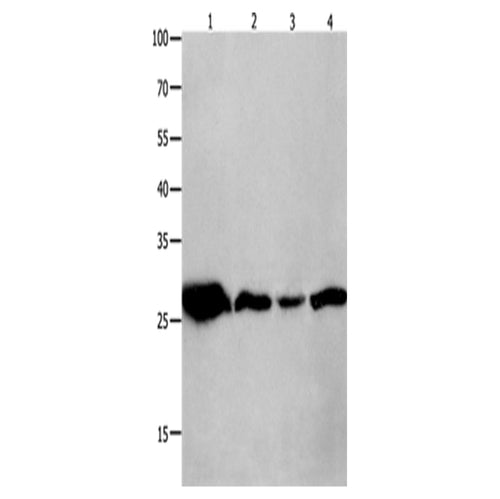 YWHAQ rabbit polyclonal antibody