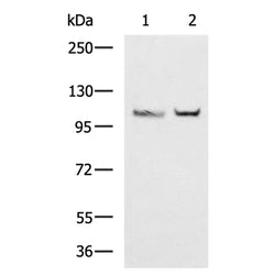 CDH1 rabbit polyclonal antibody