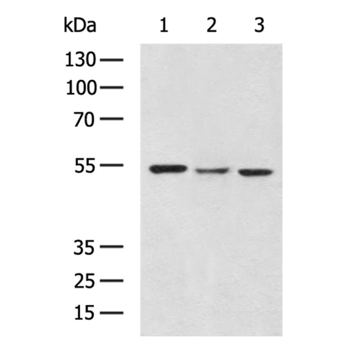 PFKFB4 rabbit polyclonal antibody