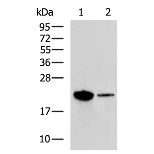 ADM rabbit polyclonal antibody