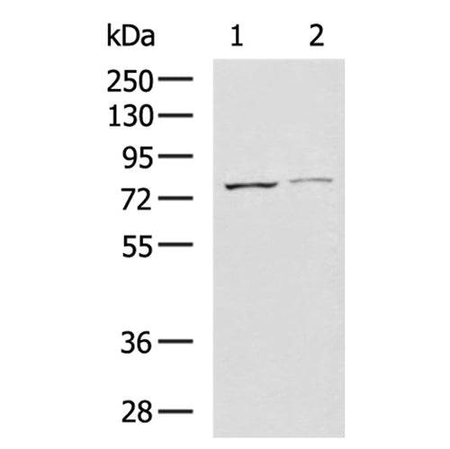 MMP2 rabbit polyclonal antibody