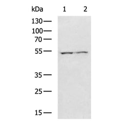 NUF2 rabbit polyclonal antibody