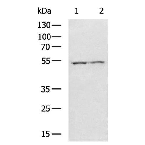 NUF2 rabbit polyclonal antibody