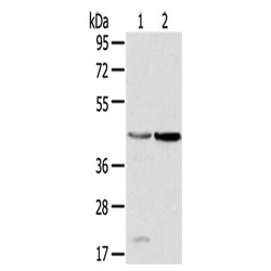 HSD11B2 rabbit polyclonal antibody