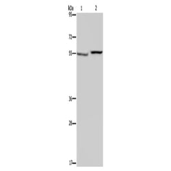 PHGDH rabbit polyclonal antibody