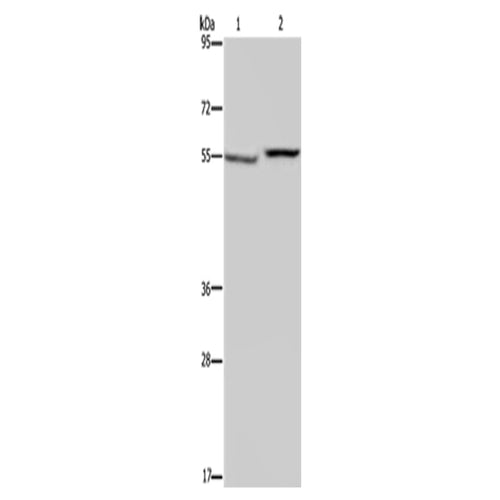 PHGDH rabbit polyclonal antibody