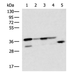 CENPV rabbit polyclonal antibody