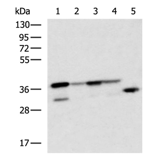 CENPV rabbit polyclonal antibody