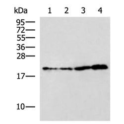 RBM38 rabbit polyclonal antibody