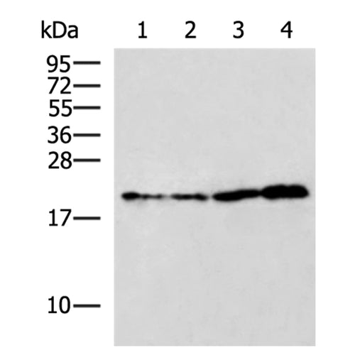 RBM38 rabbit polyclonal antibody