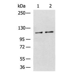 ZMIZ1 rabbit polyclonal antibody