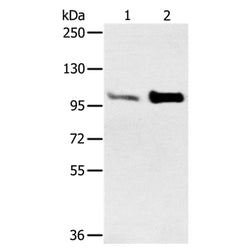 ACTN2 rabbit polyclonal antibody