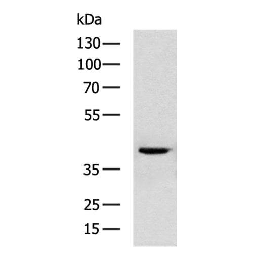 SCD rabbit polyclonal antibody