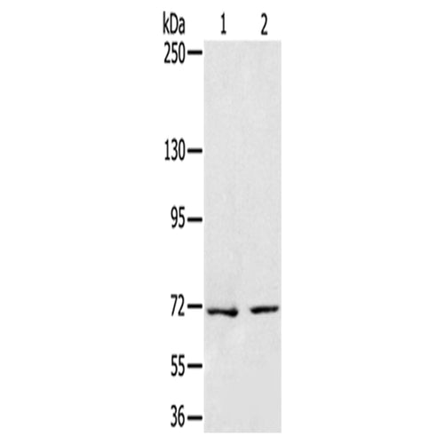 SENP1 rabbit polyclonal antibody