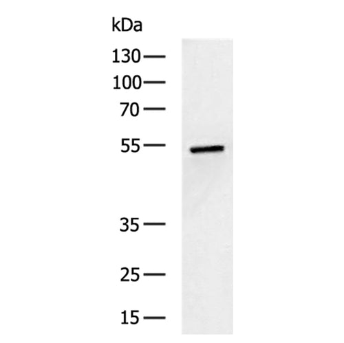SLC16A10 rabbit polyclonal antibody