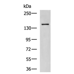 SLIT3 rabbit polyclonal antibody