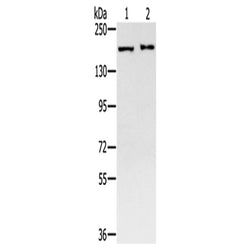 SMC4 rabbit polyclonal antibody