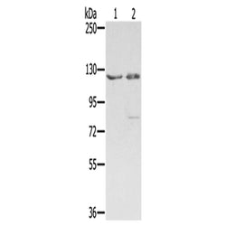 SMC6 rabbit polyclonal antibody