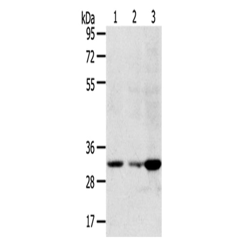 CCS rabbit polyclonal antibody