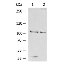ROR1 rabbit polyclonal antibody
