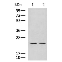 UBTD1 rabbit polyclonal antibody