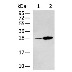 RHOU rabbit polyclonal antibody