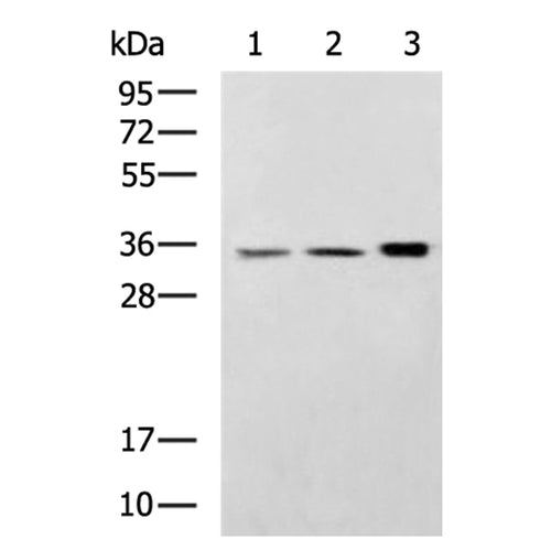 CTSS rabbit polyclonal antibody
