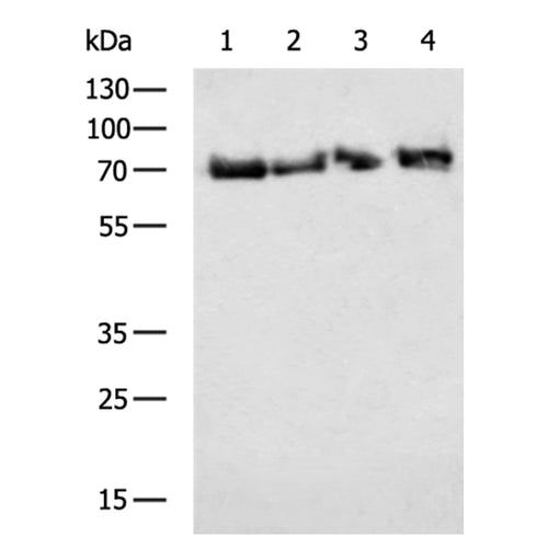 MTA2 rabbit polyclonal antibody