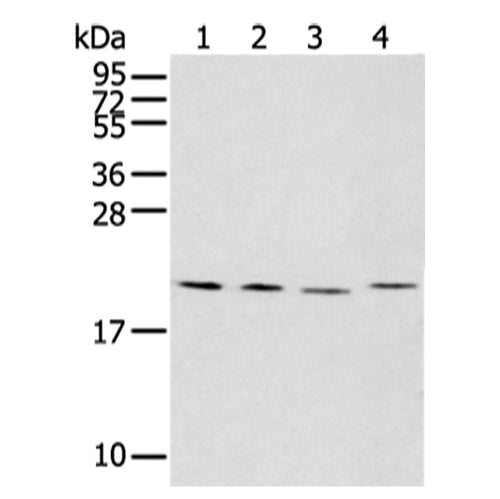 KLRC2 rabbit polyclonal antibody