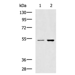 GSK3A rabbit polyclonal antibody