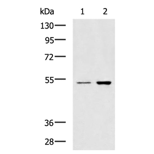 GSK3A rabbit polyclonal antibody