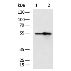 DES rabbit polyclonal antibody